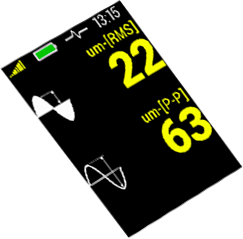 A4900 Vibrio Displacement